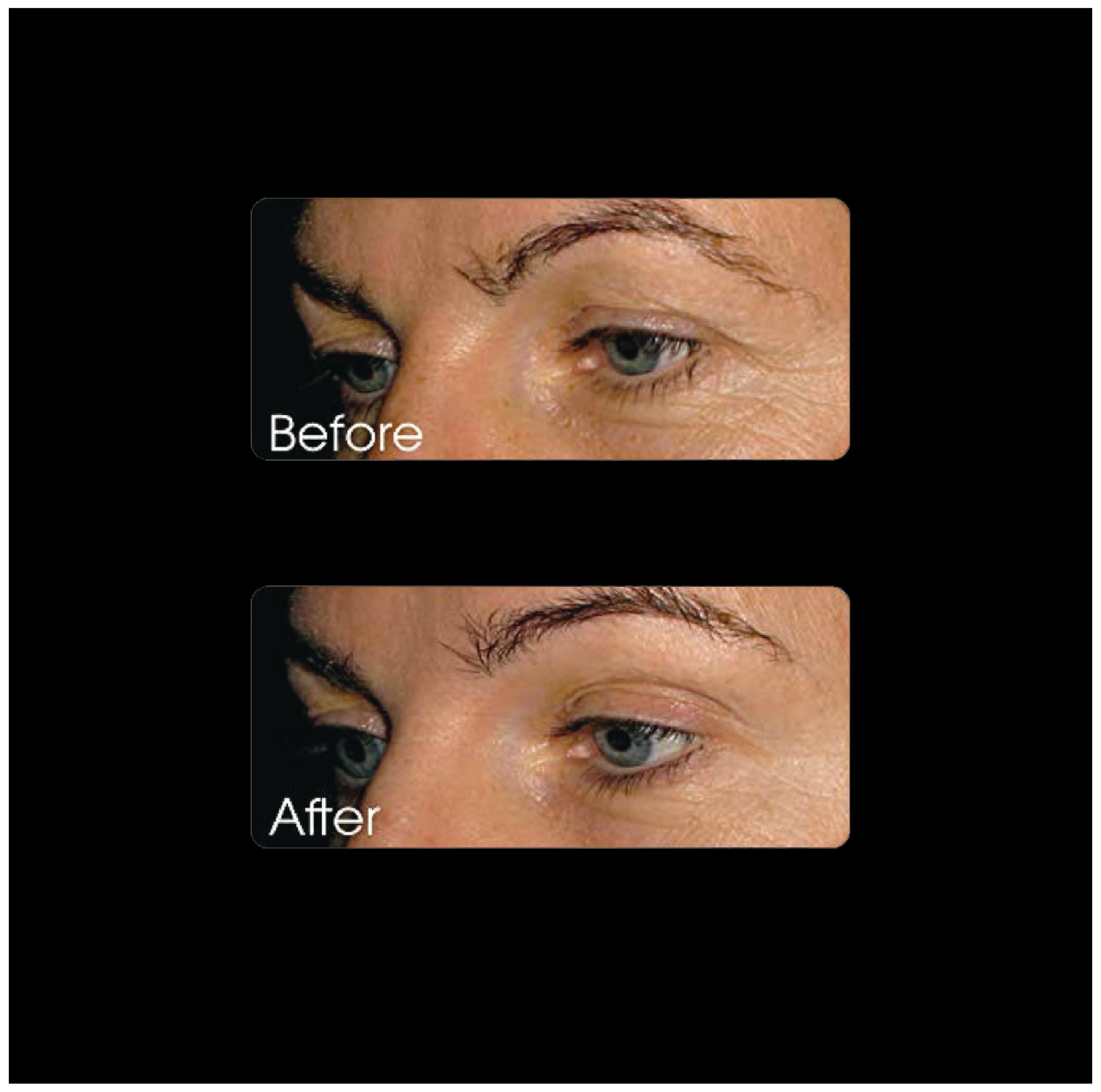 before and after miracle collagen